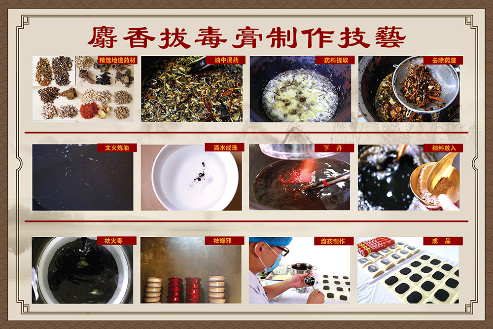 把“非遗名医”请回家：色情论坛
上门服务，让重度褥疮患者重获新生